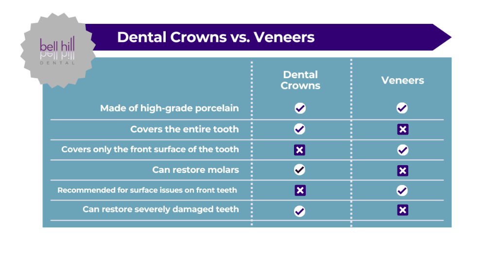 cosmetic dentist dunedin | dental crowns vs. veneers