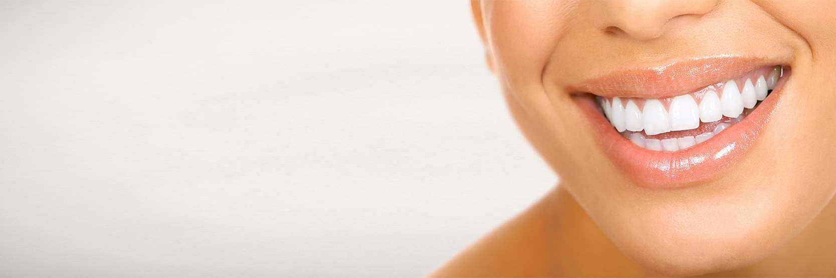 cosmetic dentist dunedin | porcelain venners