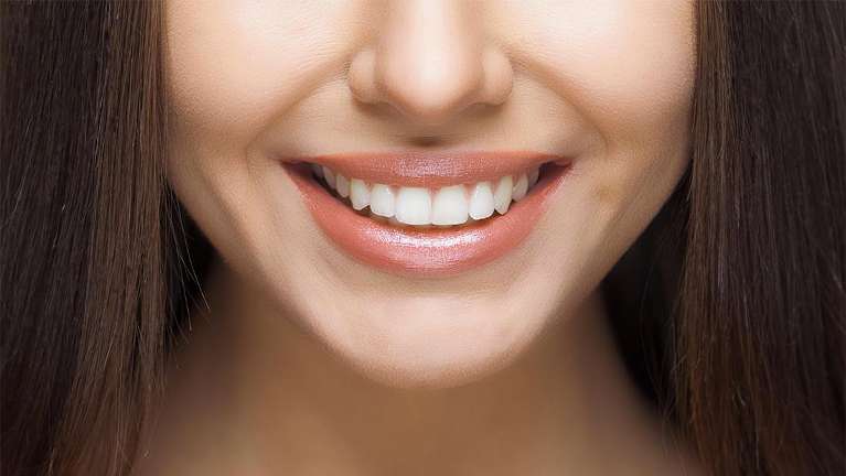 cosmetic dentist dunedin | woman smiling