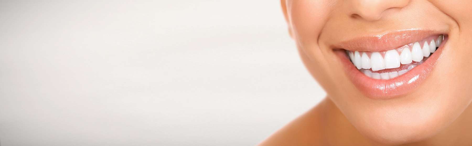 Close up of patient's smile after teeth whitening in Dunedin, Otago