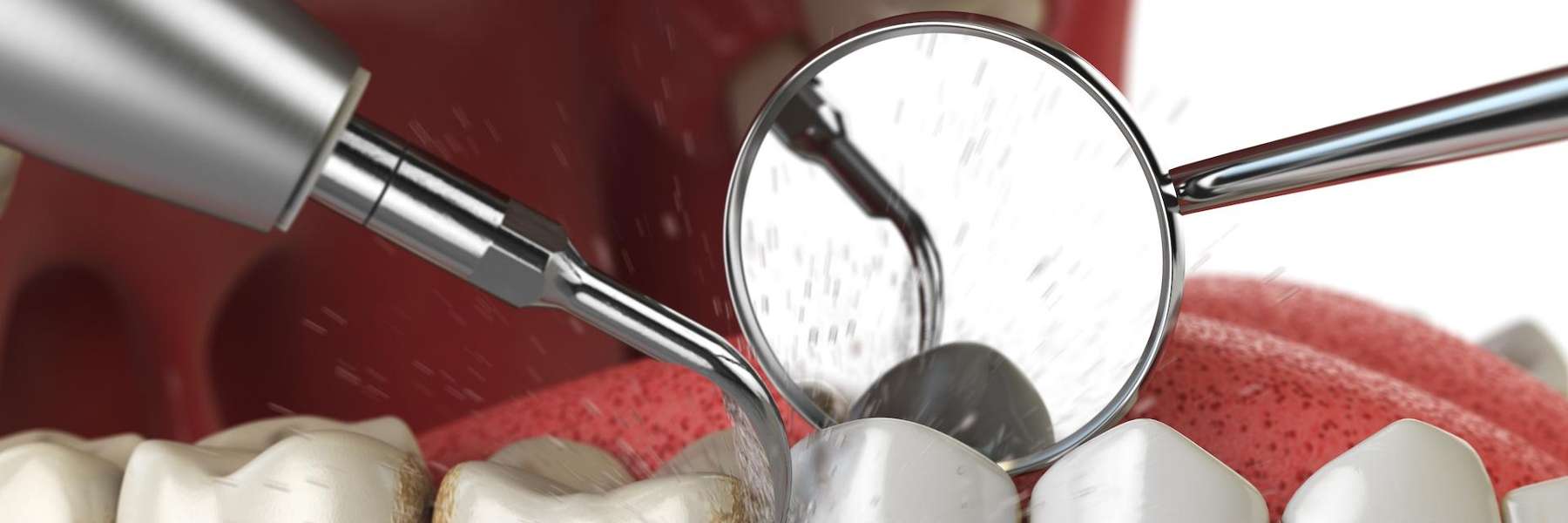 close up of teeth and gums getting cleaned by dental tools